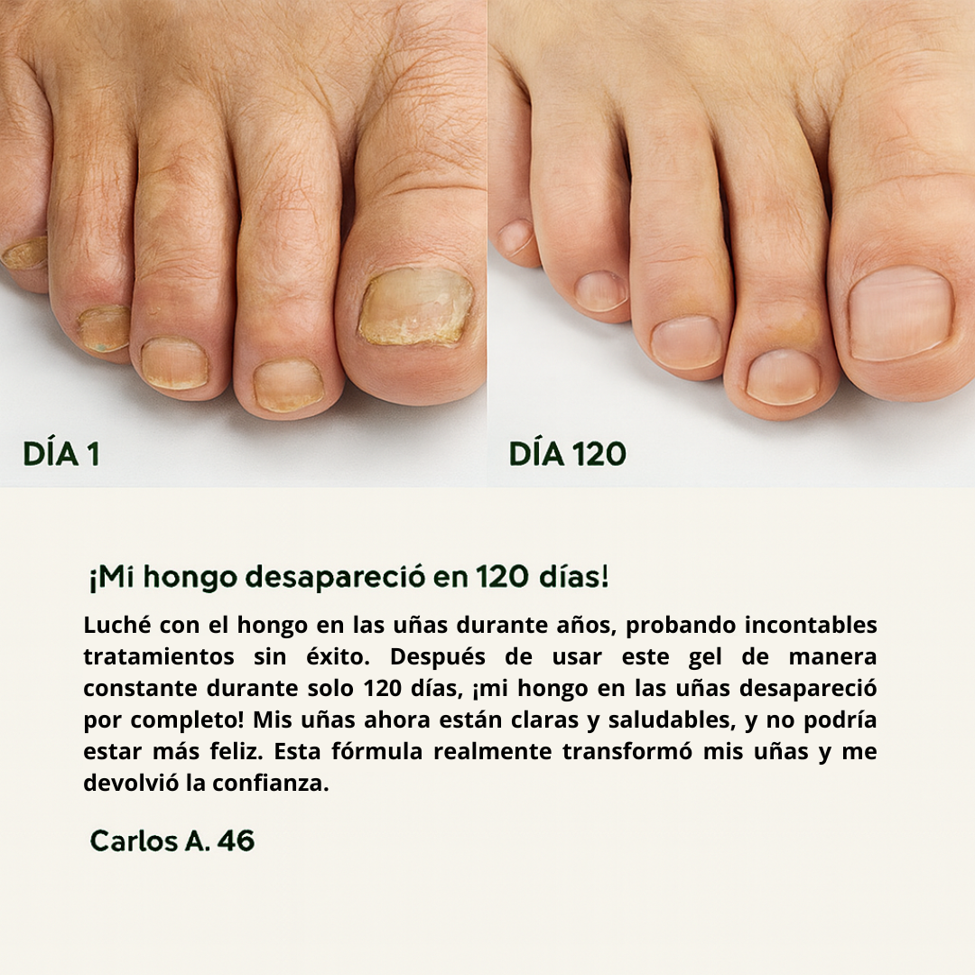 ByeFungus™ – Decile adiós a los hongos y disfrutá de unas uñas sanas.